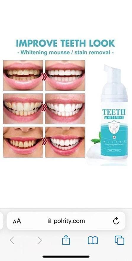 Teeth Whitening Foam