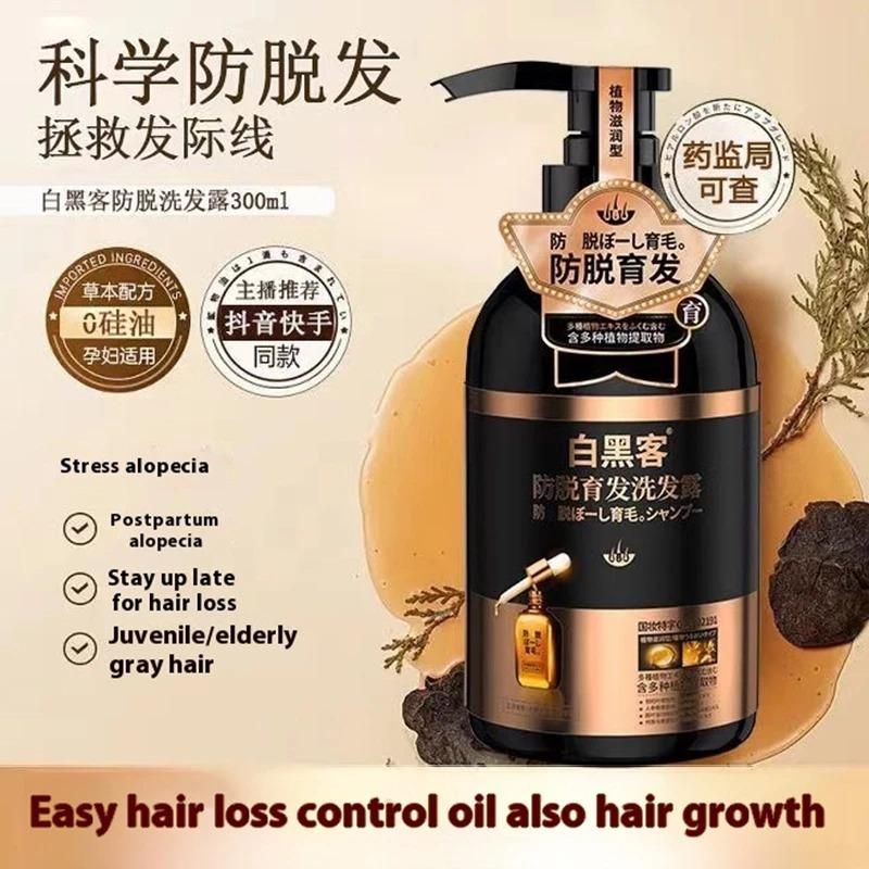 🎀 ANTI HAIR LOSS SHAMPOO 300 ML 🤩 80% Off SALE 📢