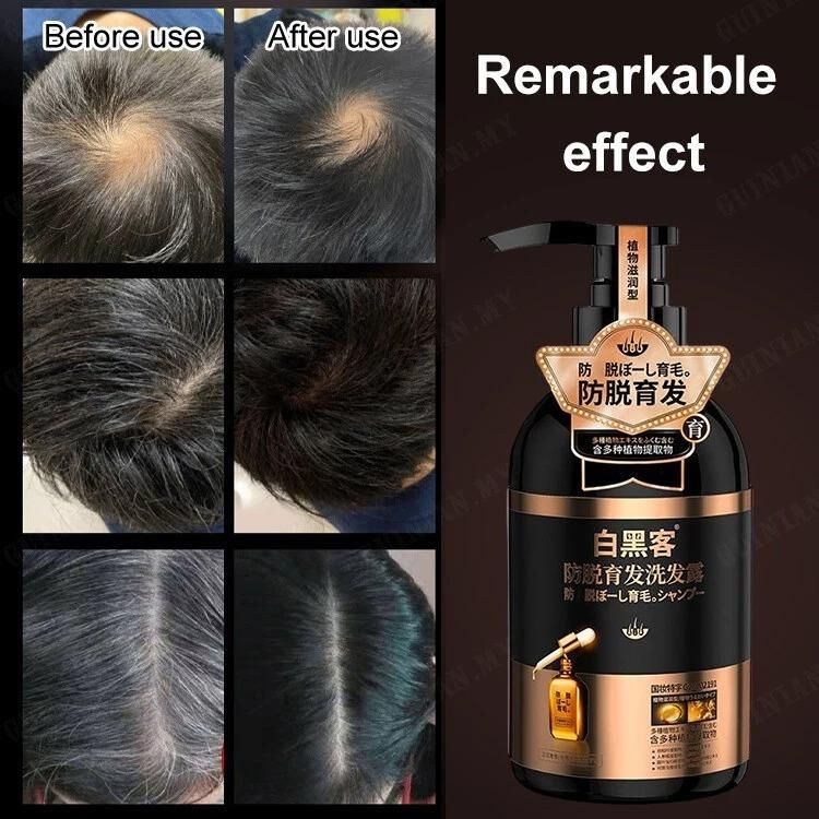 🎀 ANTI HAIR LOSS SHAMPOO 300 ML 🤩 80% Off SALE 📢